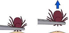 Using fine-pointed tweezers and grasp the tick's head as close to the skin as possible